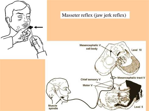 masseter compression test|Jaw jerk reflex .